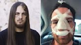 Ousted Vulvodynia Singer Insists He Never “Tried to Kill” Band’s Drummer