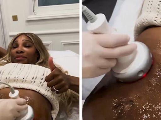 Serena Williams Gets Tummy-Tightening Procedure For Pre-Kids Confidence