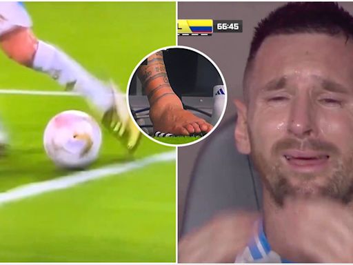 Shocking images show state of Lionel Messi's ankle during Copa America final