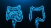 Combo therapy boosts survival for advanced colon cancer