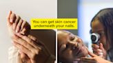 Dermatologists Who Had Skin Cancer Share 7 Warnings That Can Save Your Life