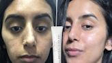 The £30 spot treatment TikTok can't stop raving about for clear skin