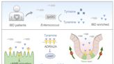 Scientists propose therapeutic approach for inflammatory bowel disease