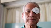 If Medicare Covers Cataract Surgery, Why Are There Bills?