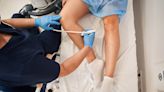 Spider Veins and Varicose Veins - Not Just A Cosmetic Problem
