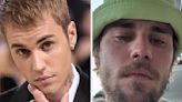 After Justin Bieber Posted Crying Selfies On Instagram, There's New Reports On His Mental Health