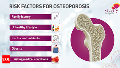 Understanding Osteoporosis: Causes, prevention, and management - Times of India