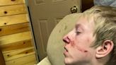 Teen survives terrifying bear attack thanks to his brother