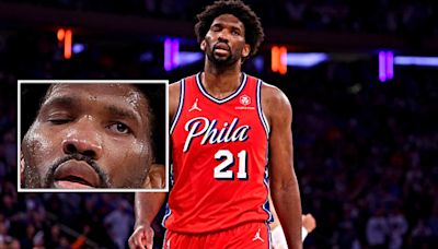 Sports Doctor Discusses His Concerns on Joel Embiid's Bizarre Eye Movements | FOX Sports Radio