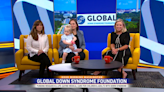 Meet Global Down Syndrome Amabassador , nearly 3-year-old Isla Eager