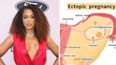 Eve Revealed That She Had An Ectopic Pregnancy: "I Don't Know Why I Lied To Everyone On Set And Said That My...