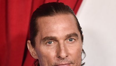 Schockfoto von Matthew McConaughey: Das ist mit seinem Auge passiert