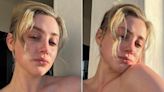 Lili Reinhart Says She’s Struggled with Acne Since She Was 12 in New Makeup-Free Selfies: ‘This Is My Skin’