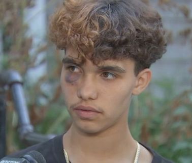 Competing narratives amid police investigation into trans teen assault in Gloucester