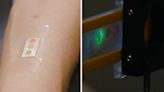 Goodbye needles: Tiny laser in band-aid tracks glucose from sweat