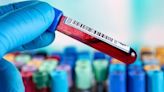 New Blood Test Could Spot Dangerous Type of Stroke