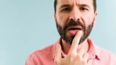 El síndrome que agrieta lo labios y provoca mal aliento: qué lo causa y cómo evitarlo