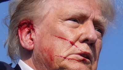 Trump confirms he will speak from Wisconsin following attempted assassination