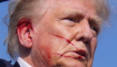 FBI confirms that a bullet or bullet fragment hit Trump during assassination attempt