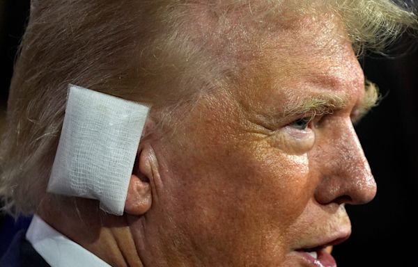 Trump is back out in the spotlight for the first time after his assassination attempt, and he's wearing a massive rectangular bandage over his ear