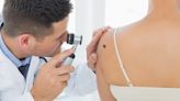 El melanoma, la variedad más rara de cáncer de piel: seis claves para prevenirlo