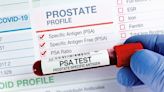 New Screening Protocol May Improve Prostate Cancer Detection