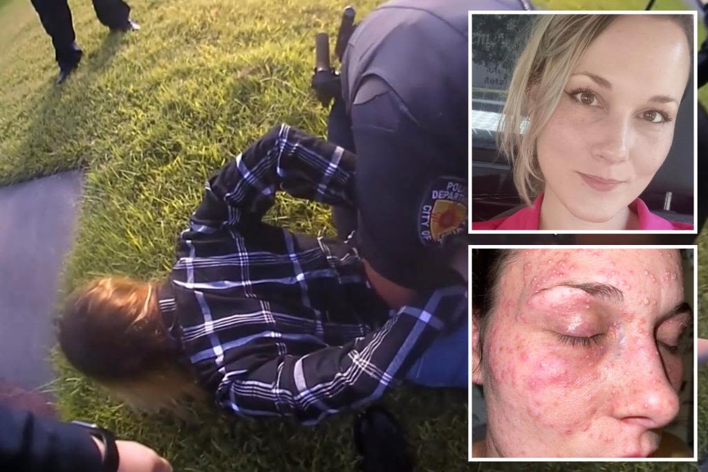 Texas mom claims police cuffed her on pile of fire ants as pests bit her all over her face: lawsuit