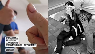 快訊／中捷英雄「長髮哥」最新傷勢曝 左臉9CM撕裂傷骨折、預計1周出院