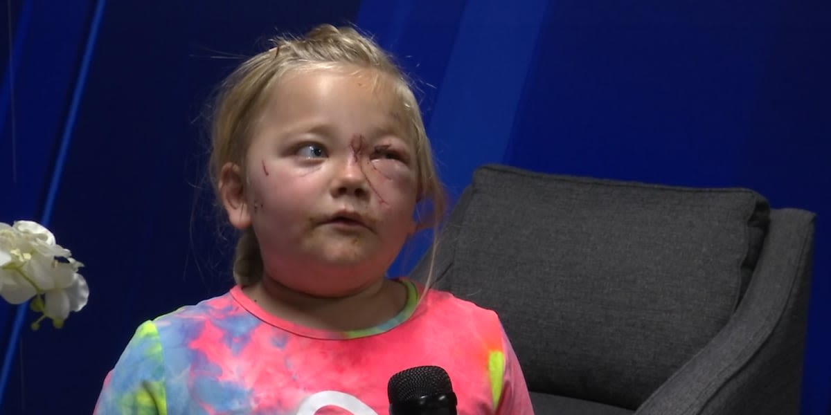 GRAPHIC: Boy saves 6-year-old sister during dog attack: ‘I didn’t want her to die’