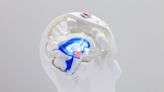 Lumière sur la maladie de Parkinson : un dispositif implanté dans la tête du patient !