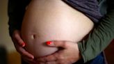 Epidurals cut risk of severe childbirth complications by 35%, research finds