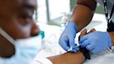 Black and Hispanic Americans are less likely to receive monkeypox vaccines: CDC