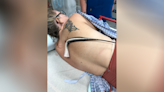 Stingray impales Florida woman’s back, misses lung by centimeters: ‘Super, super painful’