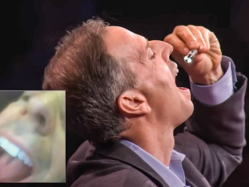 Man swallows camera live on stage to show us the insides of his stomach