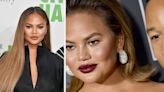 Chrissy Teigen Responded To A Follower Who Criticized Her "New Face"