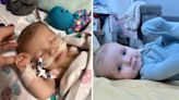 Newborn baby's 'snoring' was sign of rare heart defect requiring open-heart surgery