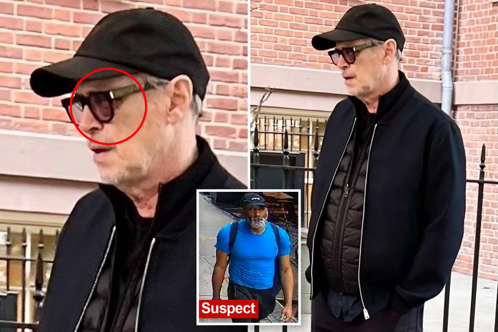 Steve Buscemi spotted with black eye, swollen face after random NYC attack