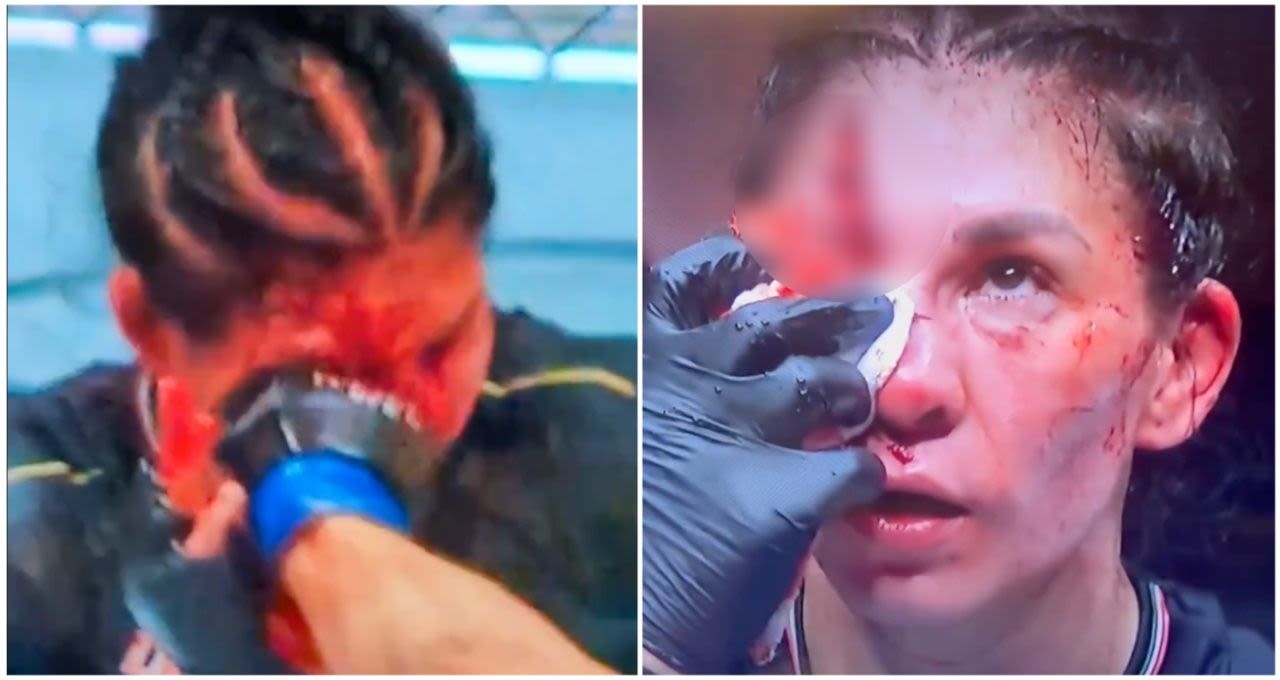 'The worst cut in UFC history' happened to Irene Aldana at UFC 306 - it is absolutely brutal