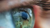 Retinal hemorrhage: Causes, risk factors, and symptoms