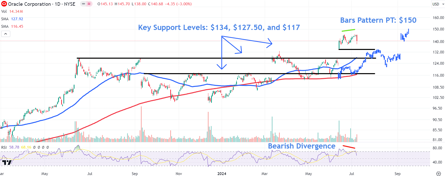 Watch These Oracle Stock Price Levels as Talks With Elon Musk's xAI End