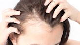 Medical Mystery: Hair Thinning, Chronic Pain, and Inflammation — What Caused This TikToker's Symptoms?