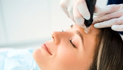 The expert guide to microneedling: From fading scars to boosting collagen