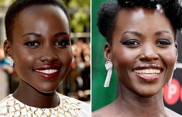 Lupita Nyong'o -- Good Genes or Good Docs?!