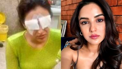 Jasmin Bhasin Says She 'Can't See Properly' After Suffering Corneal Damage