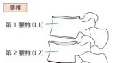 腰痠背痛又無力⋯我有椎間盤突出嗎？教你「1招」評估：抬腿就能測