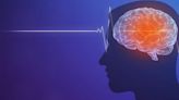 Wellness Wednesday: The signs and symptoms of a stroke