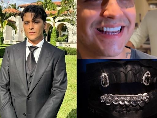 Christian Nodal presume dentadura de diamantes; filtran el precio de sus "nuevos dientes"