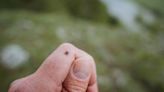 How to Identify a Tick Bite (and Prevent Future Bites)