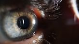 Researchers find concerning contaminant within human eyes: 'Shedding light on their potential implications'