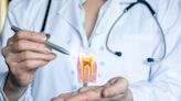 無齒症將有藥可醫？日本研發「長牙藥」9月開始臨床試驗